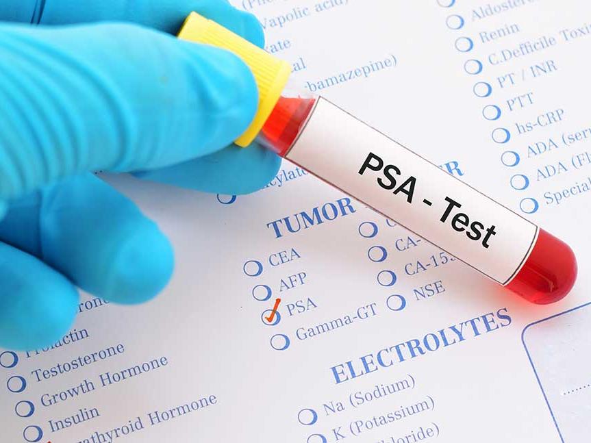 Prostate PSA Test